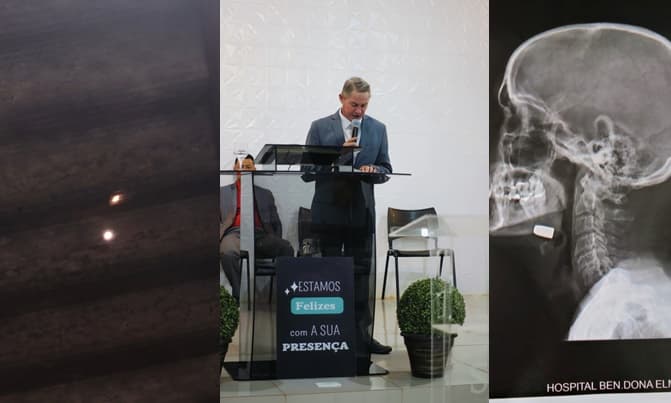 Pastor é atingido por bala perdida enquanto dormia em Sidrolândia